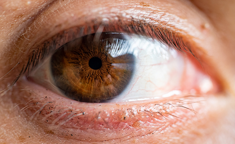 Corneal Transplants Are Safer and More Precise Than Ever at Barraquer Eye Hospital UAE